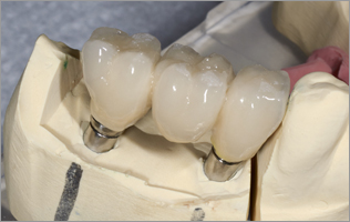 three basic types teeth